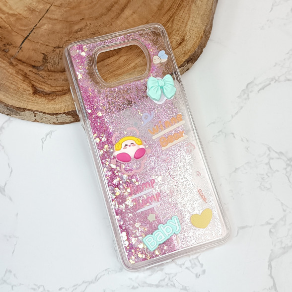 قاب آکواریومی عروسکی Xiaomi Poco X3 / X3 NFC / X3 Pro