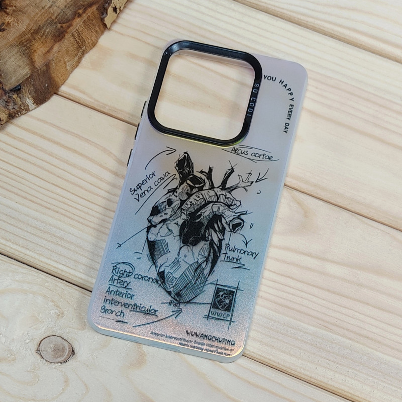 قاب So Cool فانتزی Xiaomi Redmi Note 14