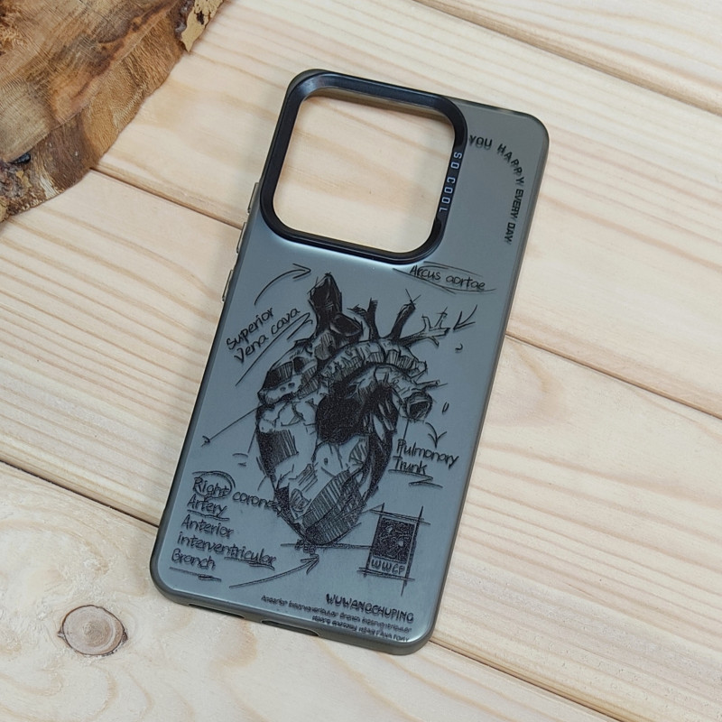 قاب So Cool فانتزی Xiaomi Redmi Note 14