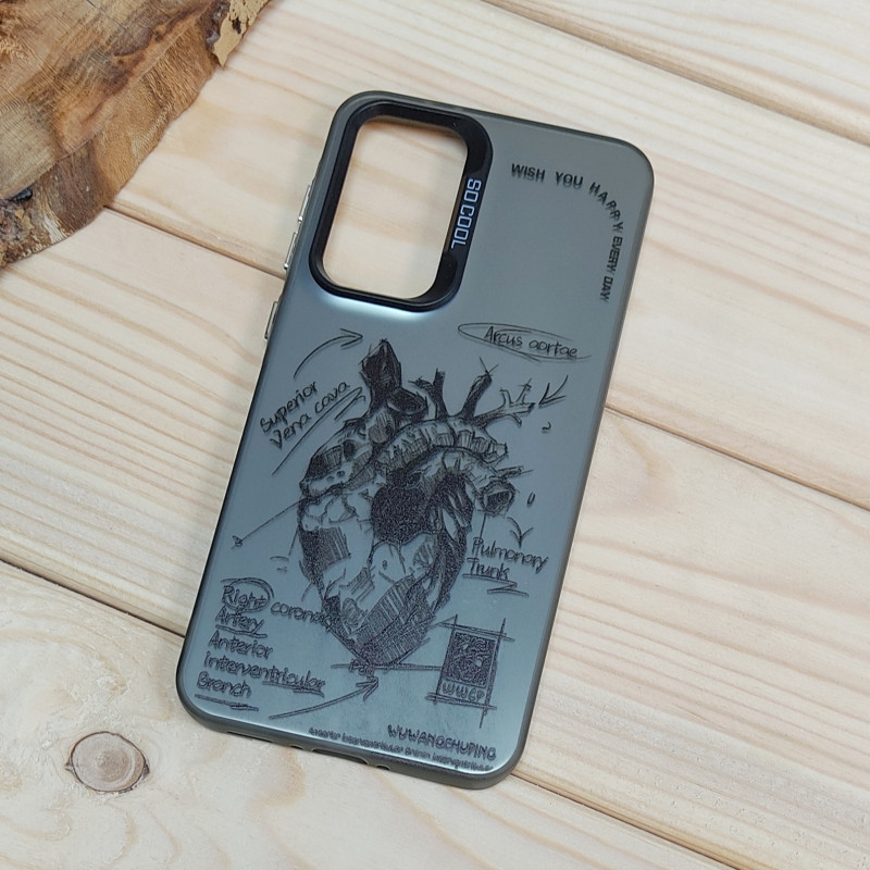 قاب So Cool فانتزی Samsung A36