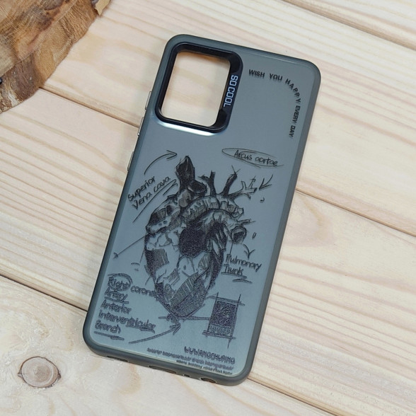 قاب So Cool فانتزی Samsung A32 4G