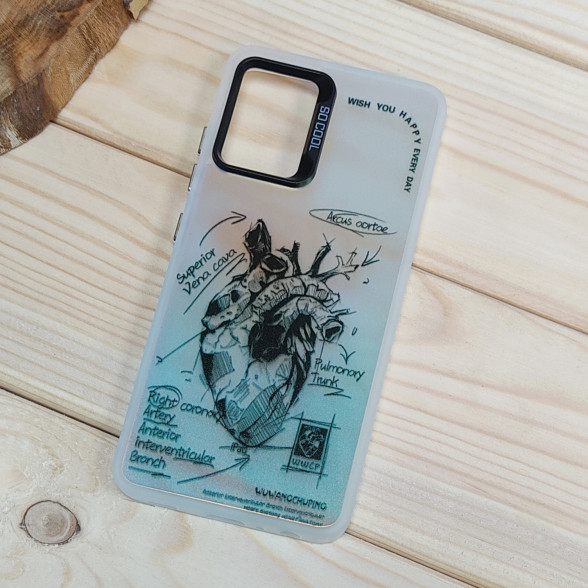 قاب So Cool فانتزی Samsung A32 4G