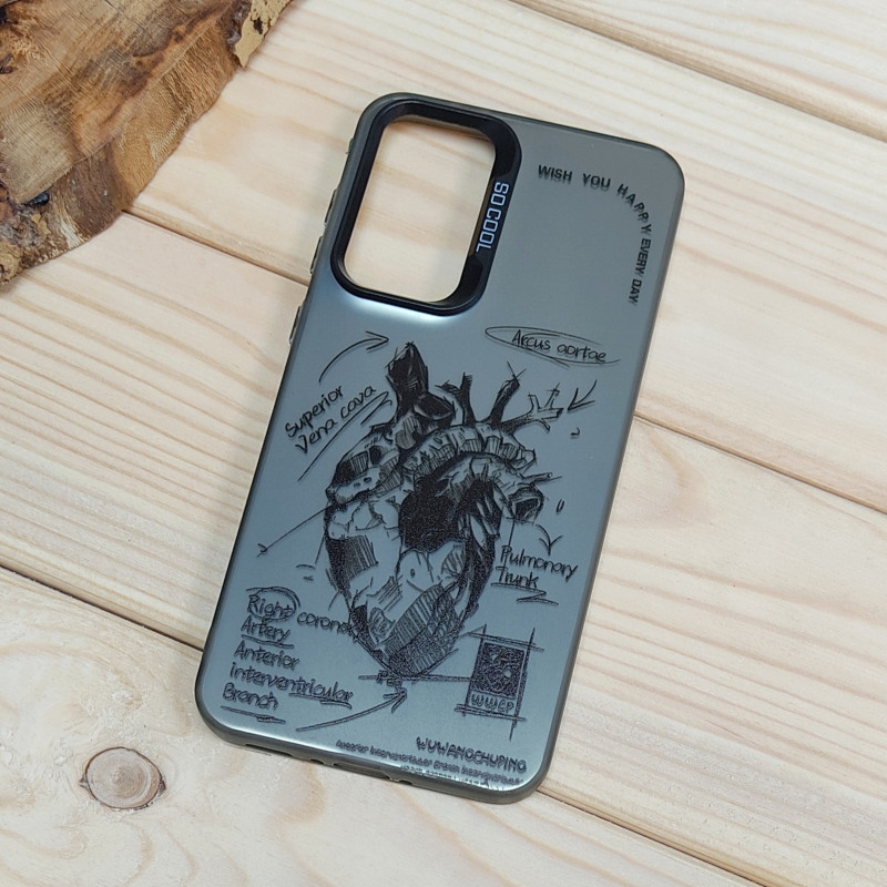 قاب So Cool فانتزی Samsung A56