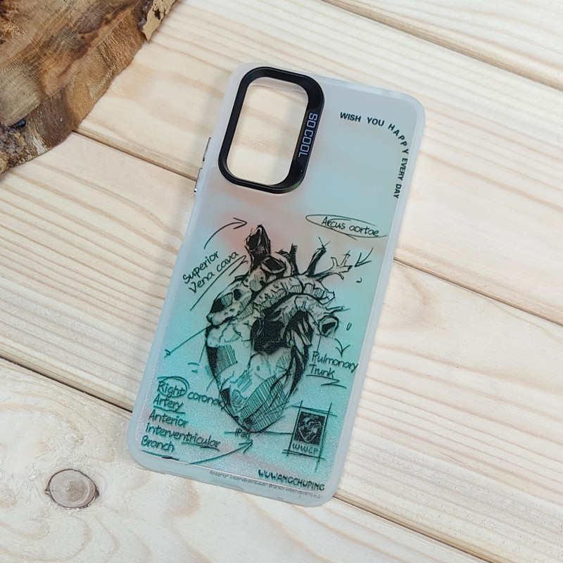 قاب So Cool فانتزی Xiaomi Redmi Note 11 4G / Note 11s