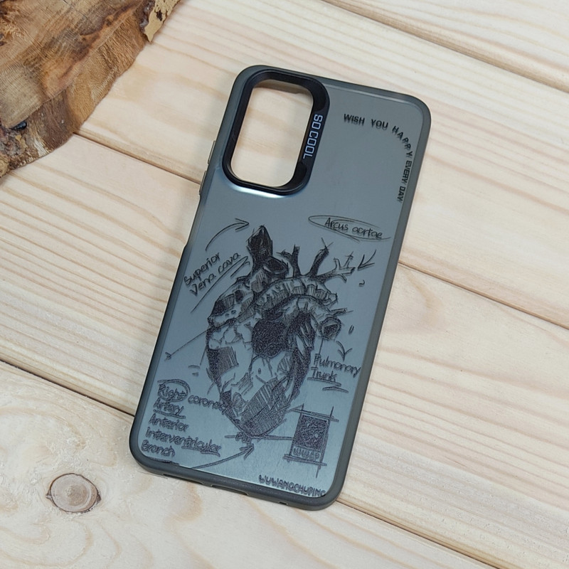 قاب So Cool فانتزی Xiaomi Redmi Note 11 4G / Note 11s