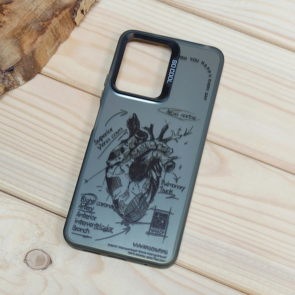 قاب So Cool فانتزی Xiaomi Redmi Note 12 4G