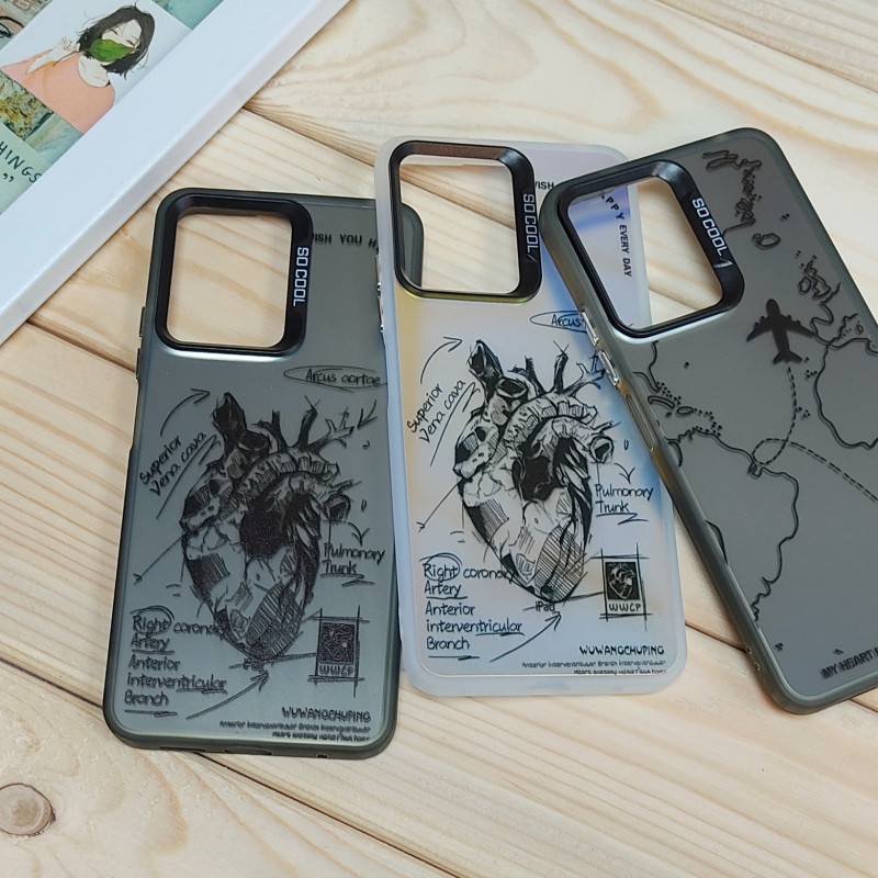 قاب So Cool فانتزی Xiaomi Redmi Note 12 4G