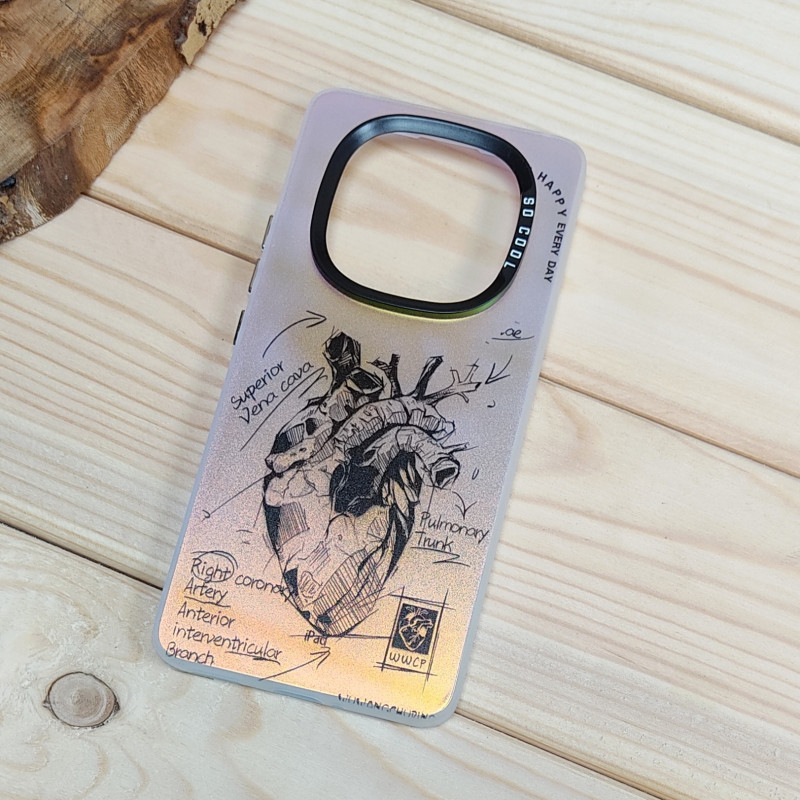 قاب So Cool فانتزی Xiaomi Redmi Note 14 Pro Plus