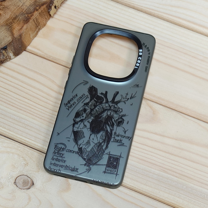 قاب So Cool فانتزی Xiaomi Redmi Note 14 Pro Plus