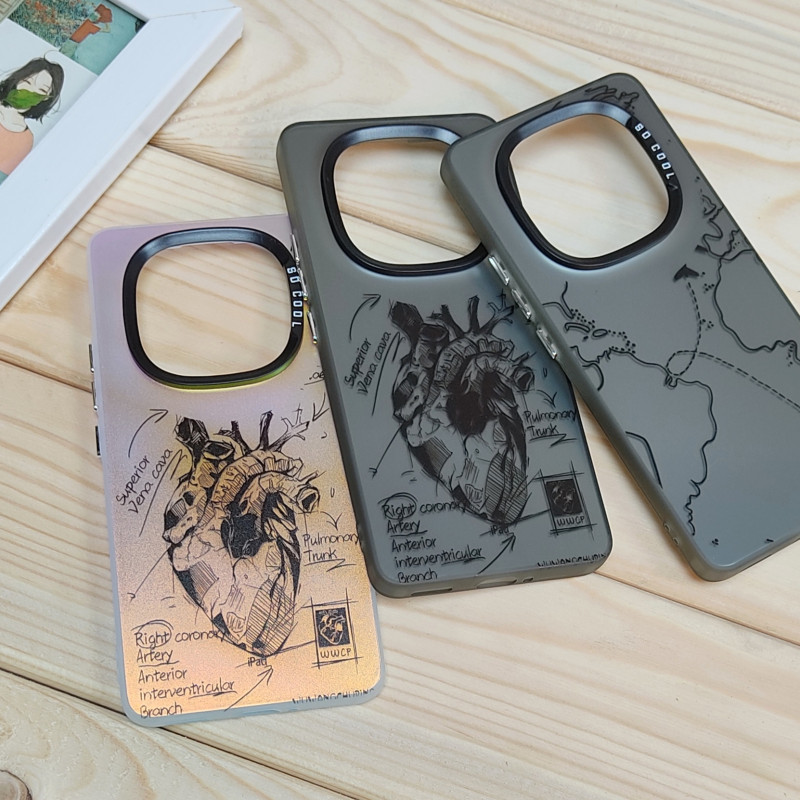 قاب So Cool فانتزی Xiaomi Redmi Note 14 Pro Plus