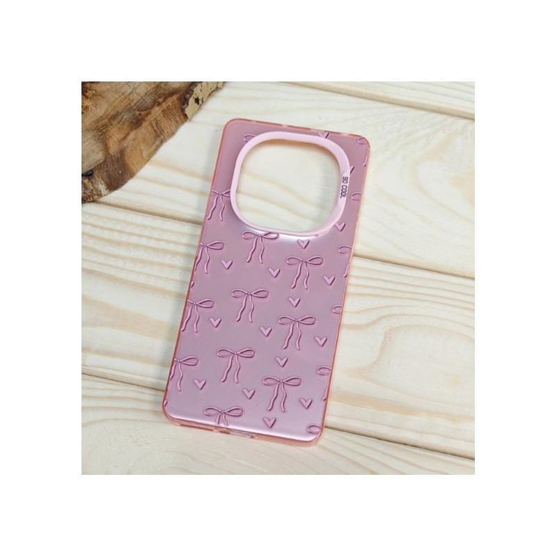 قاب So Cool فانتزی Xiaomi Redmi Note 14 Pro