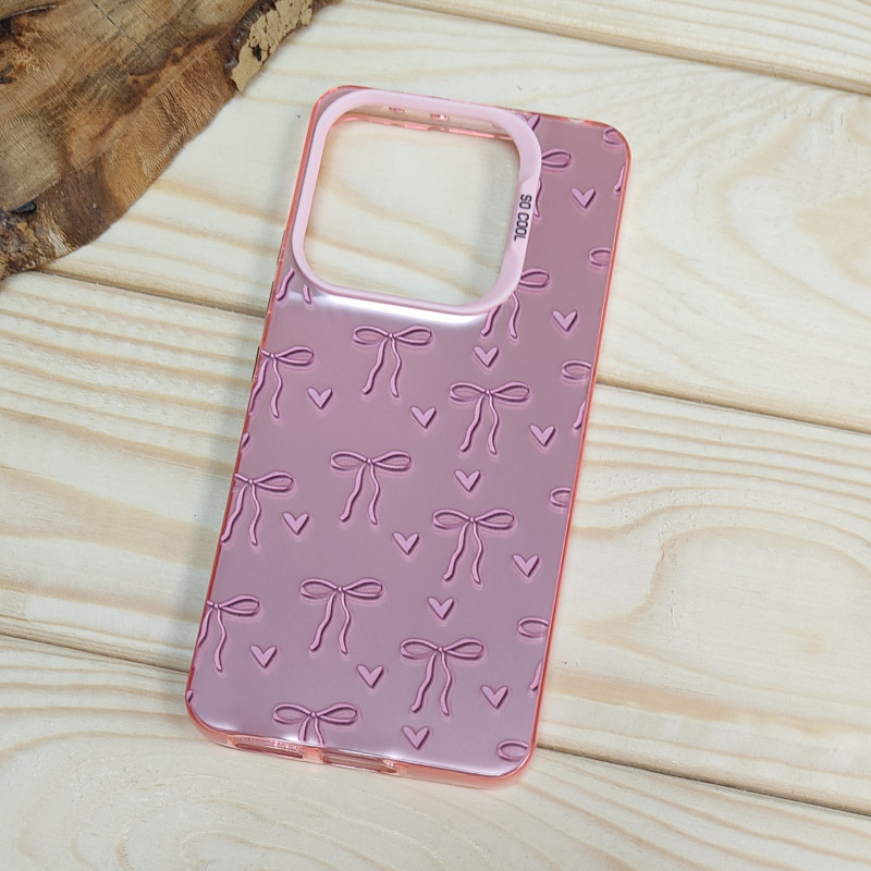 قاب So Cool فانتزی Xiaomi Redmi Note 14